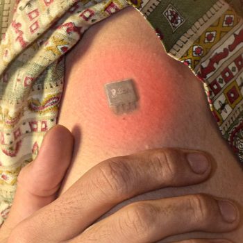 Danysswara---After-Vacine